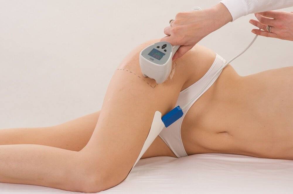 Dr. Melinda Silva MD Exilis Dr. Melinda Silva MD Exilis