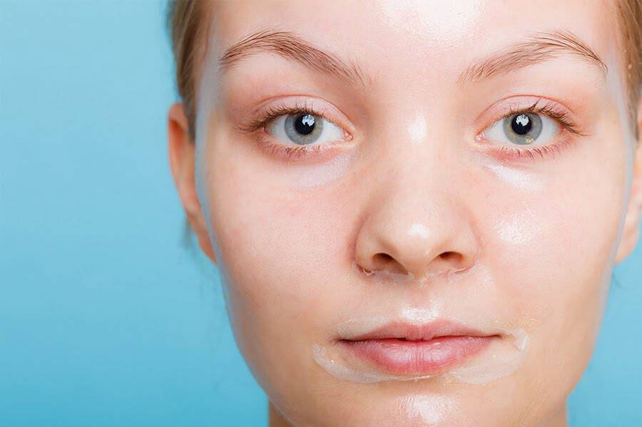 Dr. Melinda Silva MD - Salicylic Acid Peel Image Dr. Melinda Silva MD - Salicylic Acid Peel Image