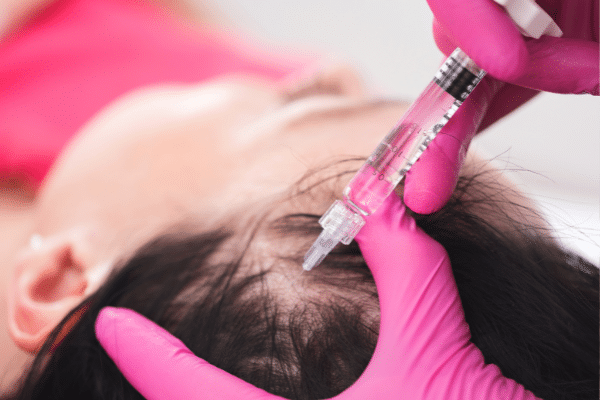 getting therapy for hairloss getting therapy for hairloss