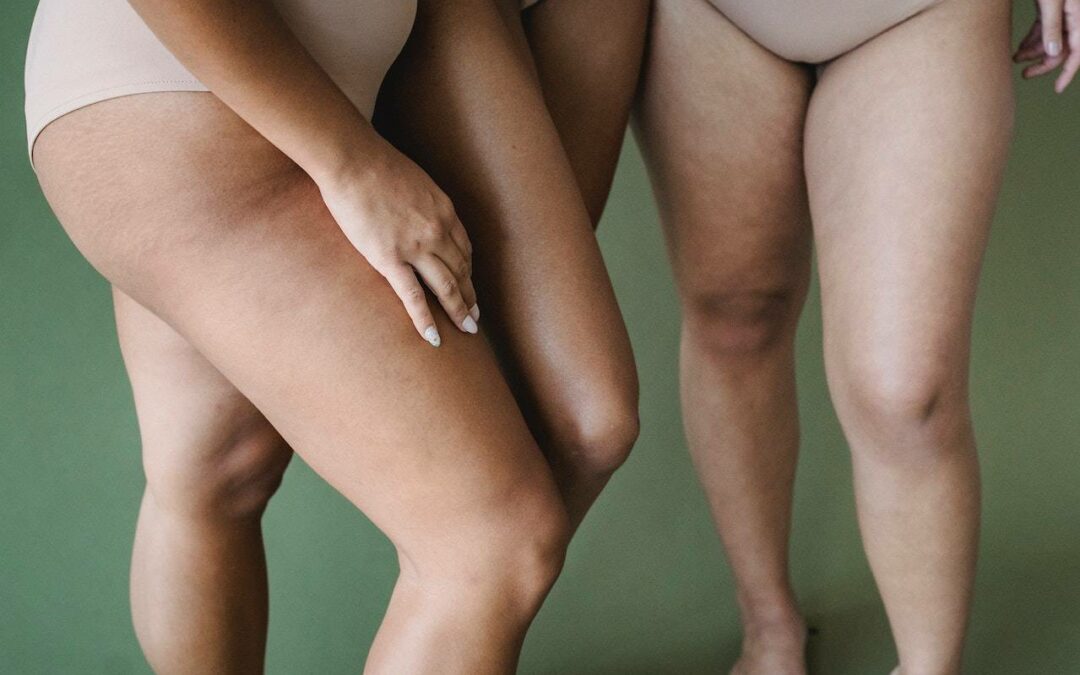women's thighs
