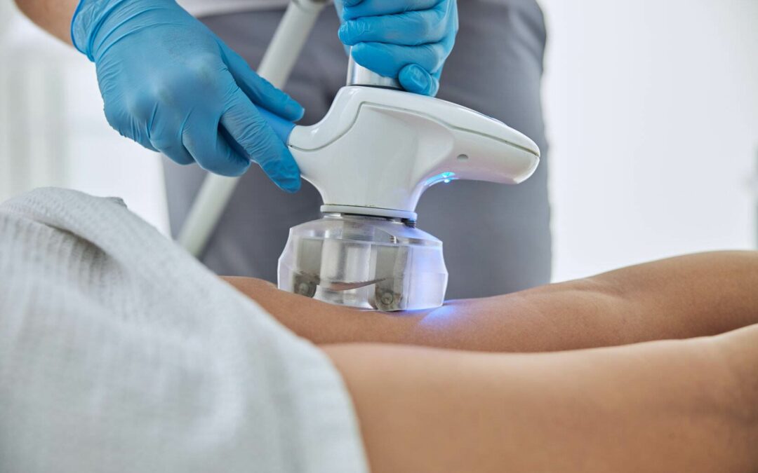 What to Know About CoolSculpting: Why Does it Cost So Much?