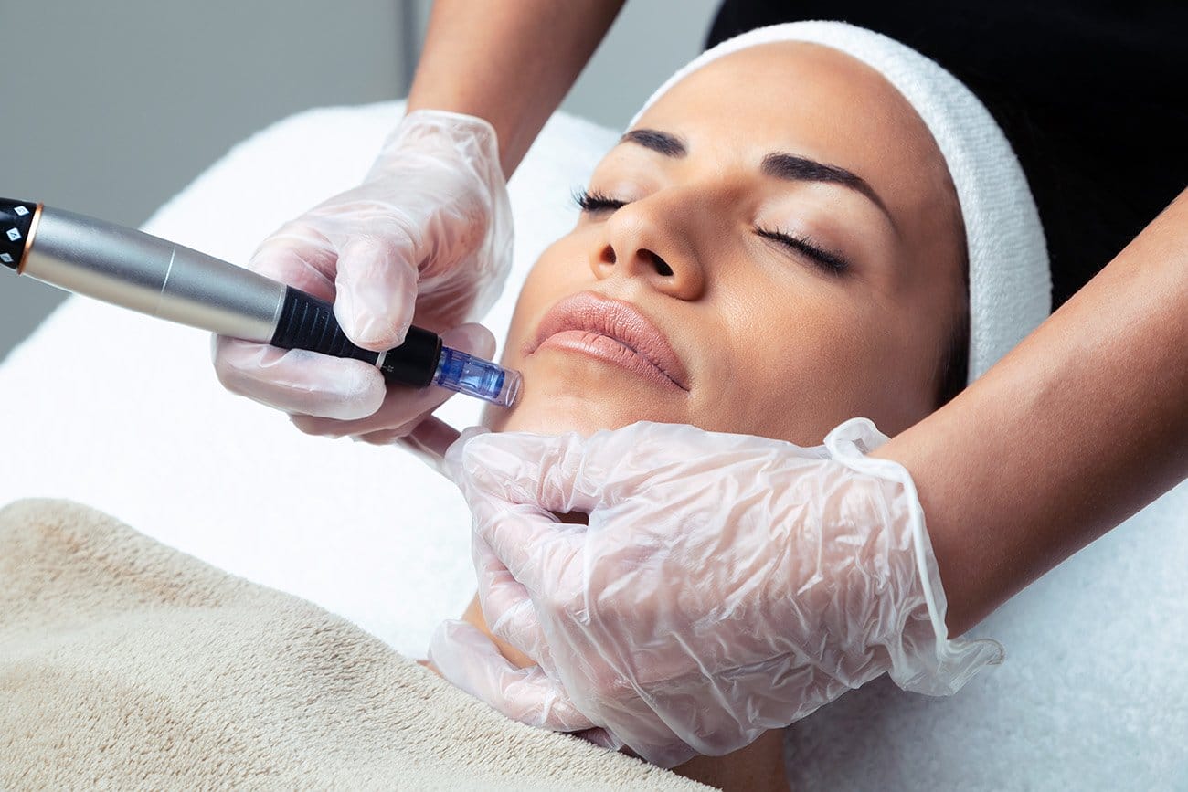 rejuvapen Dr. Melinda Silva MD - Microneedling with Rejuvapen Poster Image